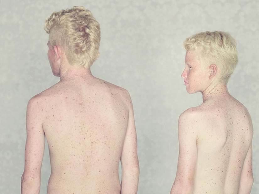 Albinos in the lens of Gustavo Lacerde