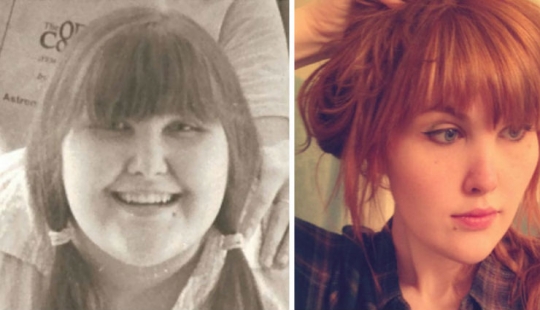 32 inspiring examples of how weight loss transforms the face