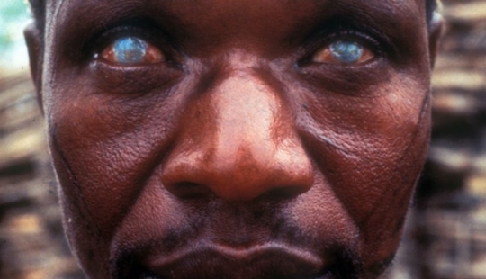 10 más terroríficos de parásitos que pueden vivir en el cuerpo humano