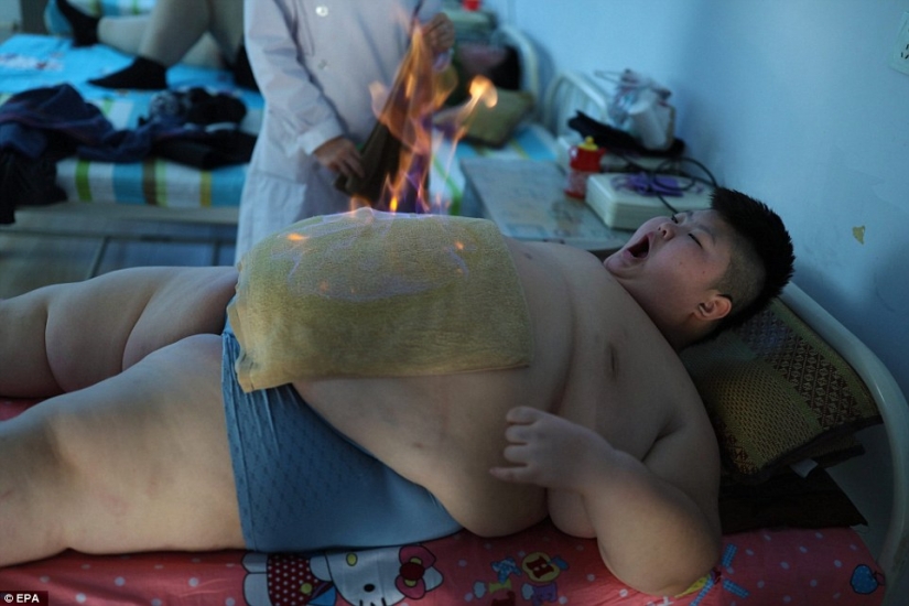 11-año-viejo hombre Chino peso 150 libras tratando de perder peso con la ayuda de fuego
