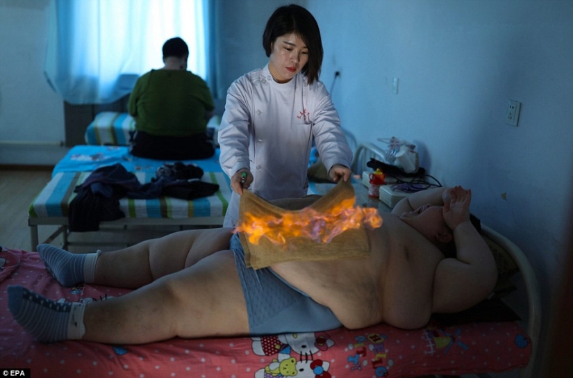 11-year-old Chinese man weighing 150 pounds trying to lose weight with the help of fire