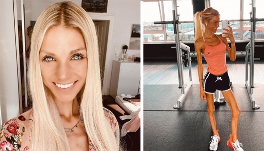 Alemán mujer hablando en instagram sobre la lucha con la anorexia, murió a la edad de 24 años