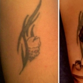 All is not lost: the brilliant examples of the repair of a failed tattoo