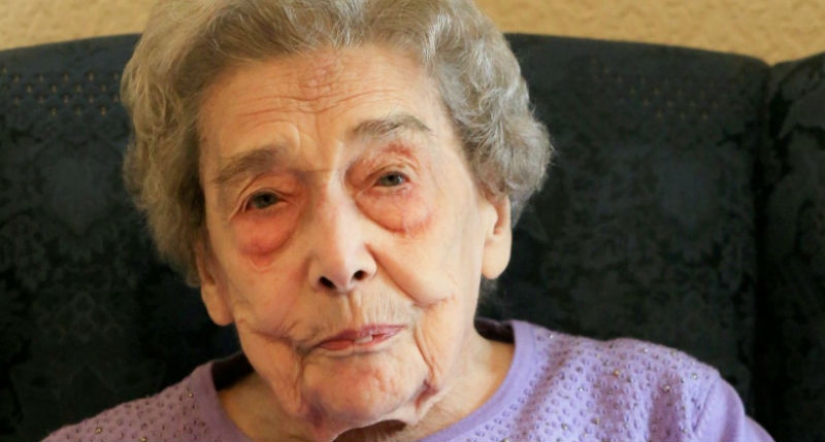 "All the ills of men": the 106-year-old woman revealed the secret of longevity