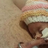 An amazing story of a tiny baby who survived in spite of everything