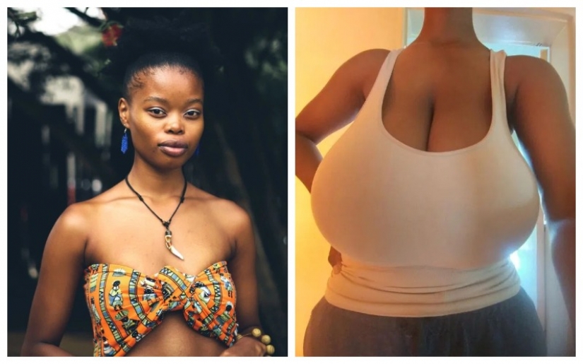 As the stone with soul: the life of a girl with 13 breast size has changed dramatically after surgery for reducing bust