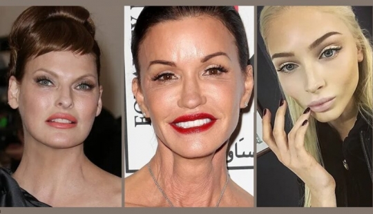 Beauty in the past: models who ruined her looks with plastic