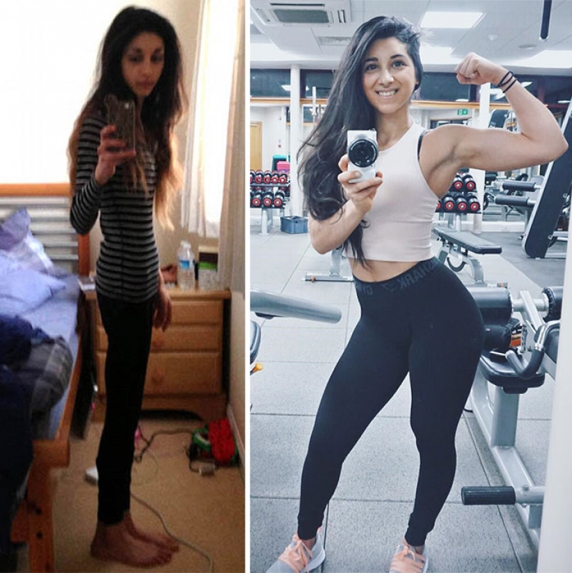 Before and after: 20 examples of people who managed to overcome anorexia