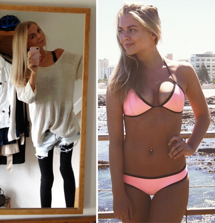 Before and after: 20 examples of people who managed to overcome anorexia