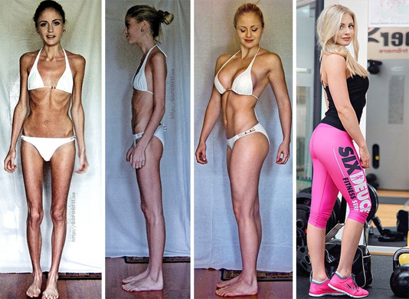 Before and after: 20 examples of people who managed to overcome anorexia