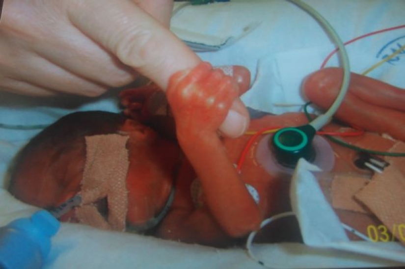 Conectados por un único destino: el milagro de los gemelos que nacieron con un descanso de 87 días