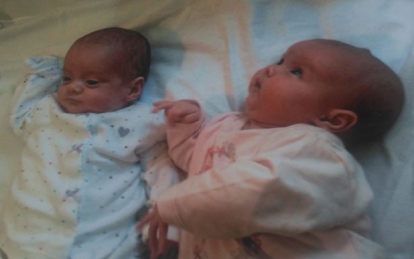 Connected by a single destiny: the miracle twins who were born with a break of 87 days