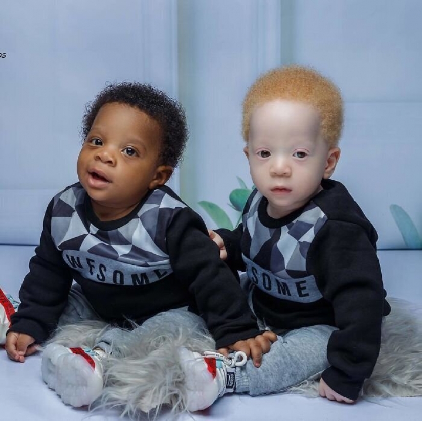 ¿Cuál es el secreto de los gemelos, con diferentes colores de piel, de Nigeria