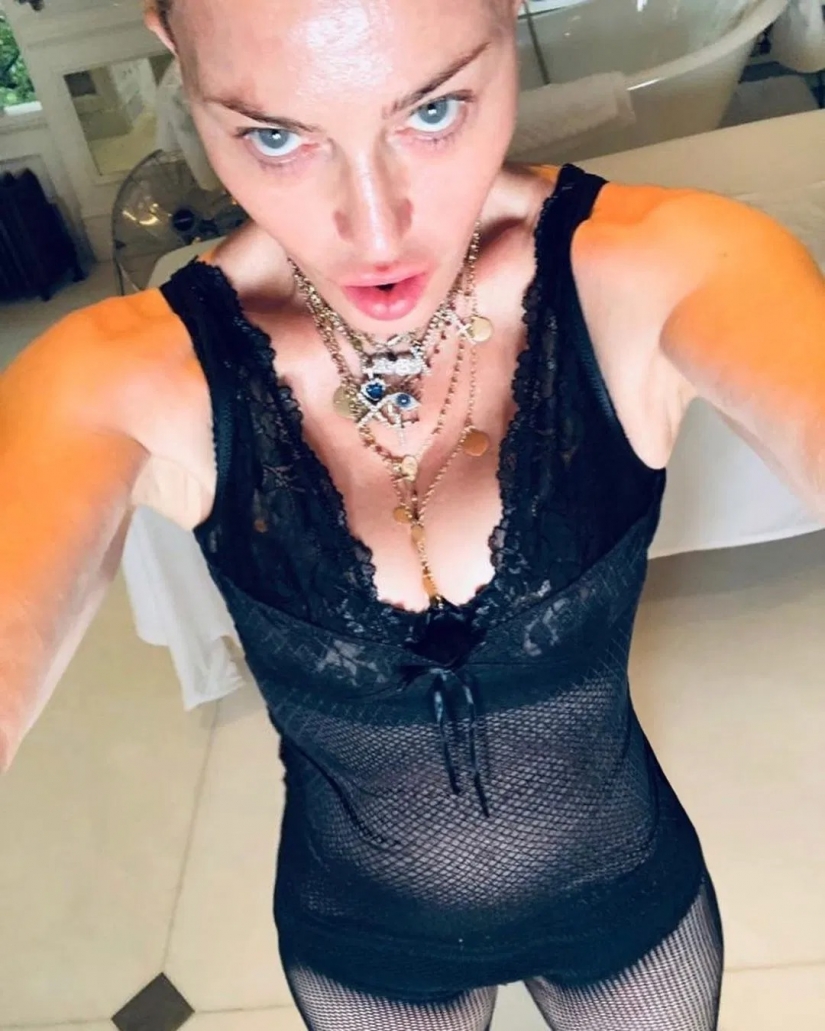 En Topless y con una muleta: de 61 años, Madonna fue golpeado por los suscriptores extraño selfie