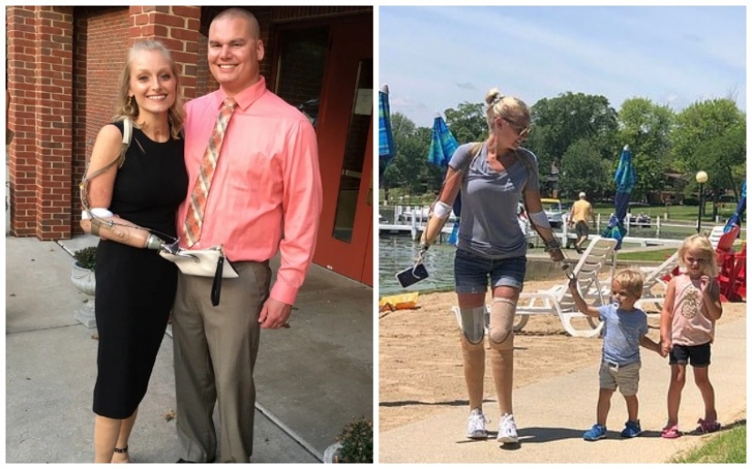 Impossible: woman without arms and legs got married, had two children and built a successful career