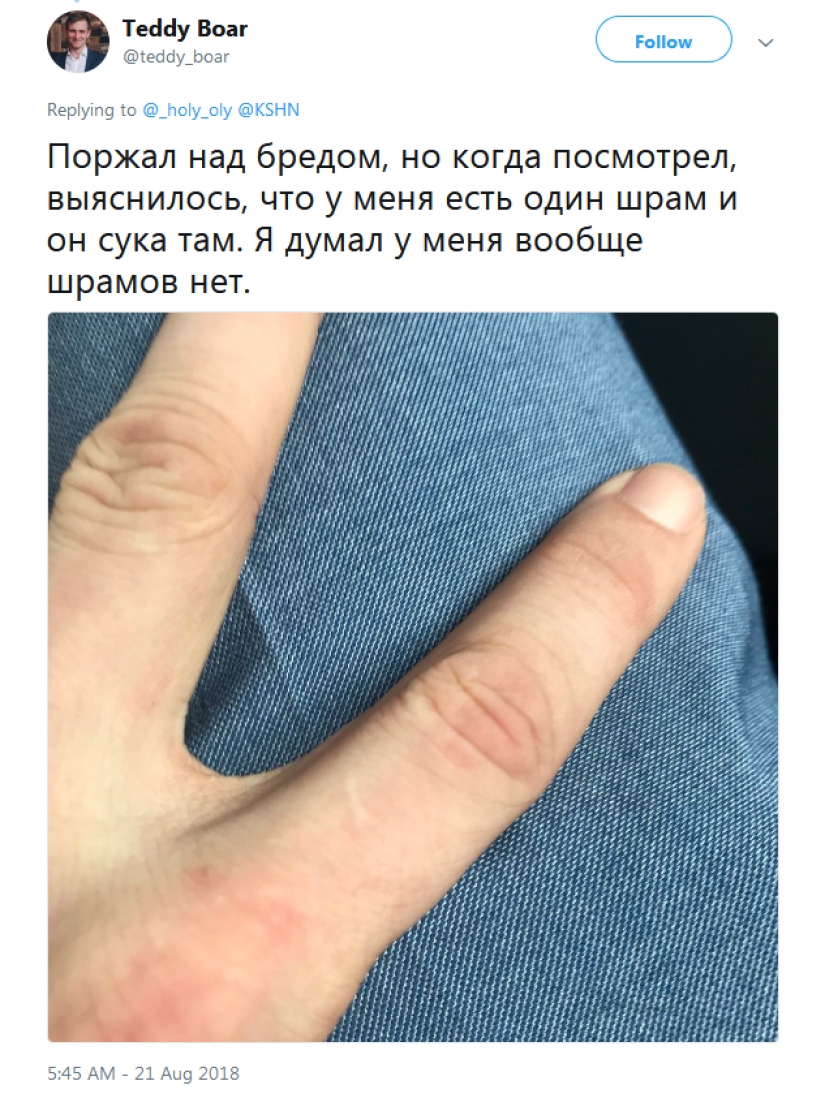 La gente de repente se dio cuenta de que todos ellos tienen una cicatriz en el dedo índice