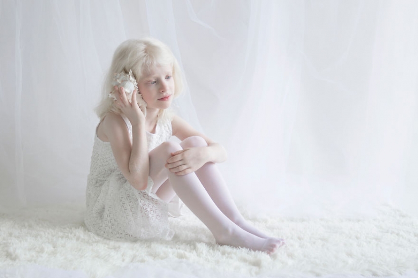 La hipnótica belleza de los albinos en el proyecto de Julia Taits