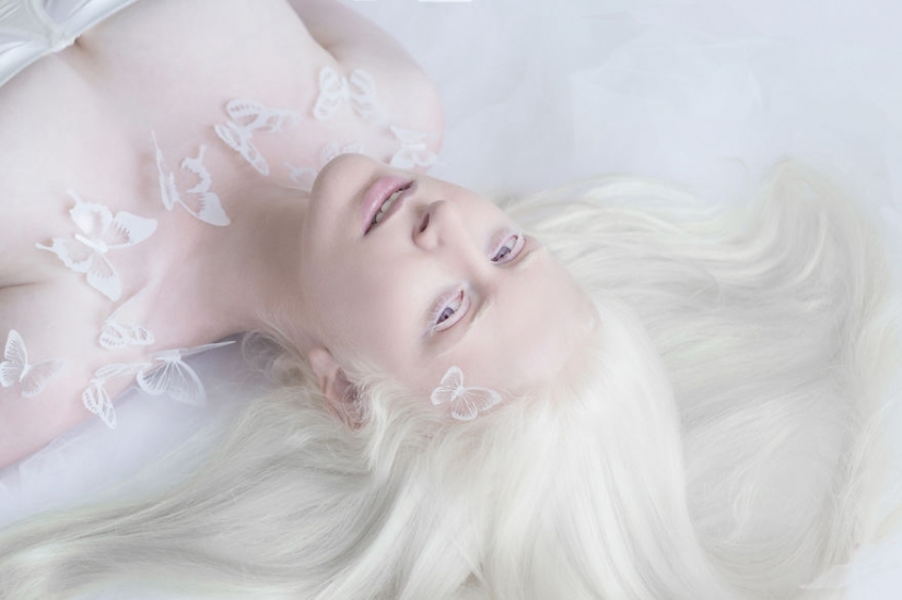 La hipnótica belleza de los albinos en el proyecto de Julia Taits