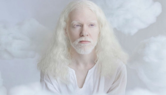 La hipnótica belleza de los albinos en el proyecto de Julia Taits