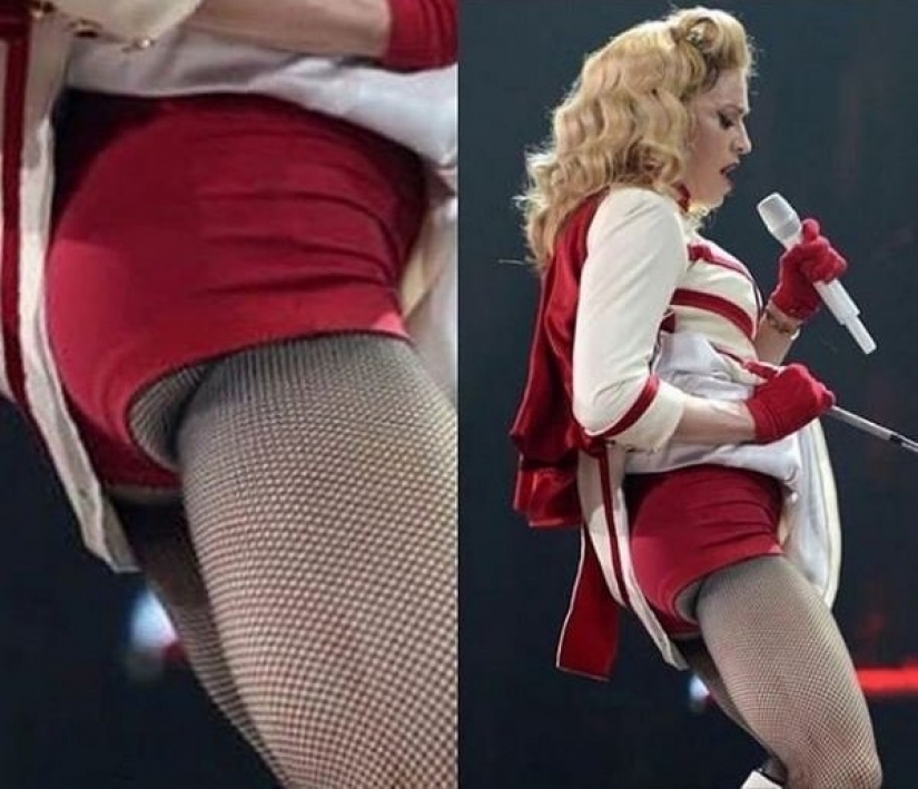 Madonna boasted powerful buttocks with implants