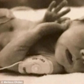 "My mother had an abortion at the 8th month, but I survived," Melissa ODEN was able to forgive and wrote a book