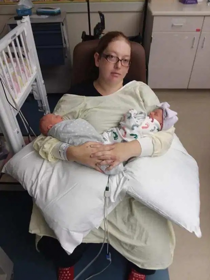 Non-random accident: a woman gave birth to triplets, not knowing about the pregnancy