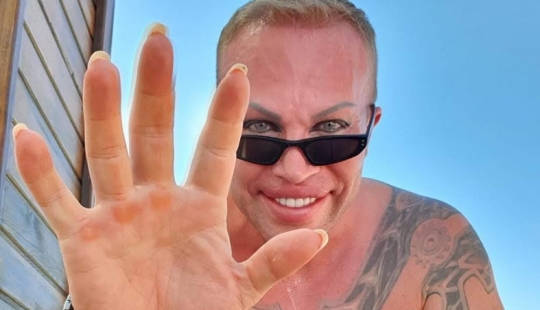 Parecía un famoso culturista-freak Alexander Shpak antes de la reencarnación