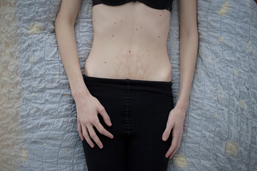 "Quiero desaparecer": una terriblemente honesto proyecto fotográfico sobre la bulimia
