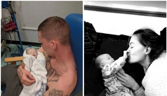 Rare syndrome: when the wife was pregnant, her husband was suffering from morning sickness and overeating