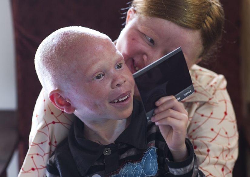 Tanzanian albinos, whose bodies are worth more than gold