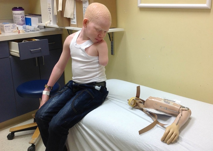 Tanzanian albinos, whose bodies are worth more than gold