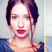 The doctors told the model to have an abortion after she has deleted 95% of the jaw to cancer — and that's what she did