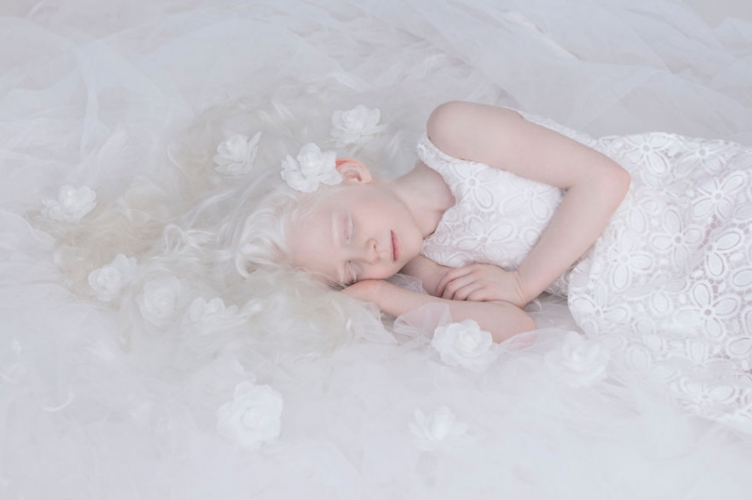 The hypnotic beauty of albinos in the project Julia Taits