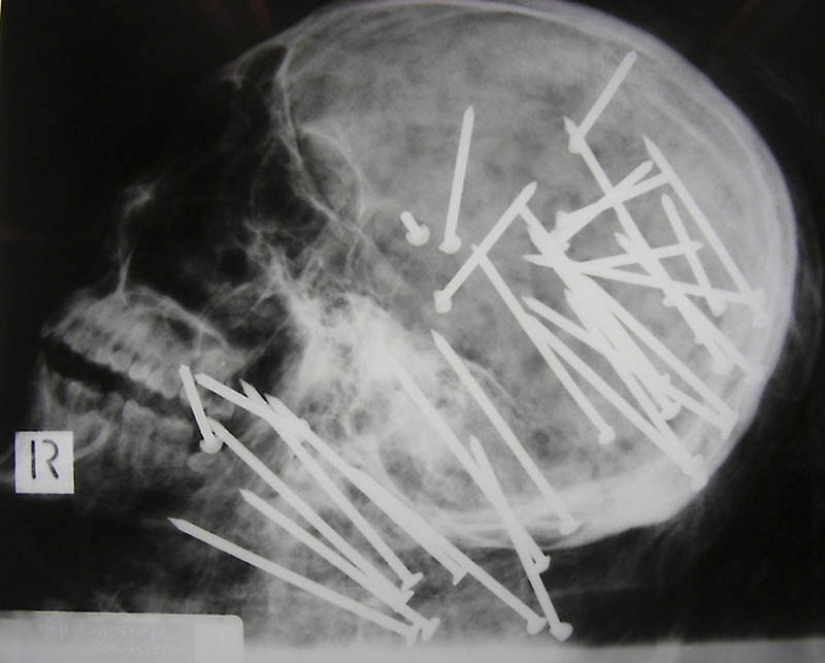 The most bizarre x-rays