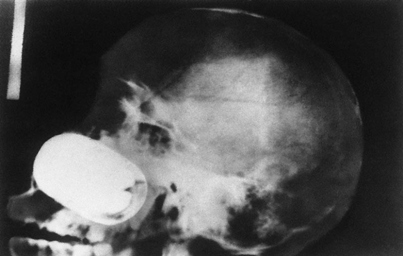 The Most Bizarre X Rays Pictolic