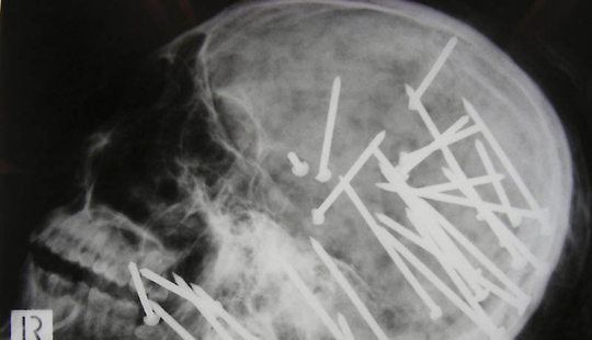 The most bizarre x-rays