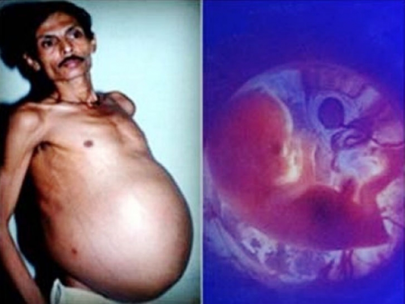 The worst items that have ever found in a human stomach