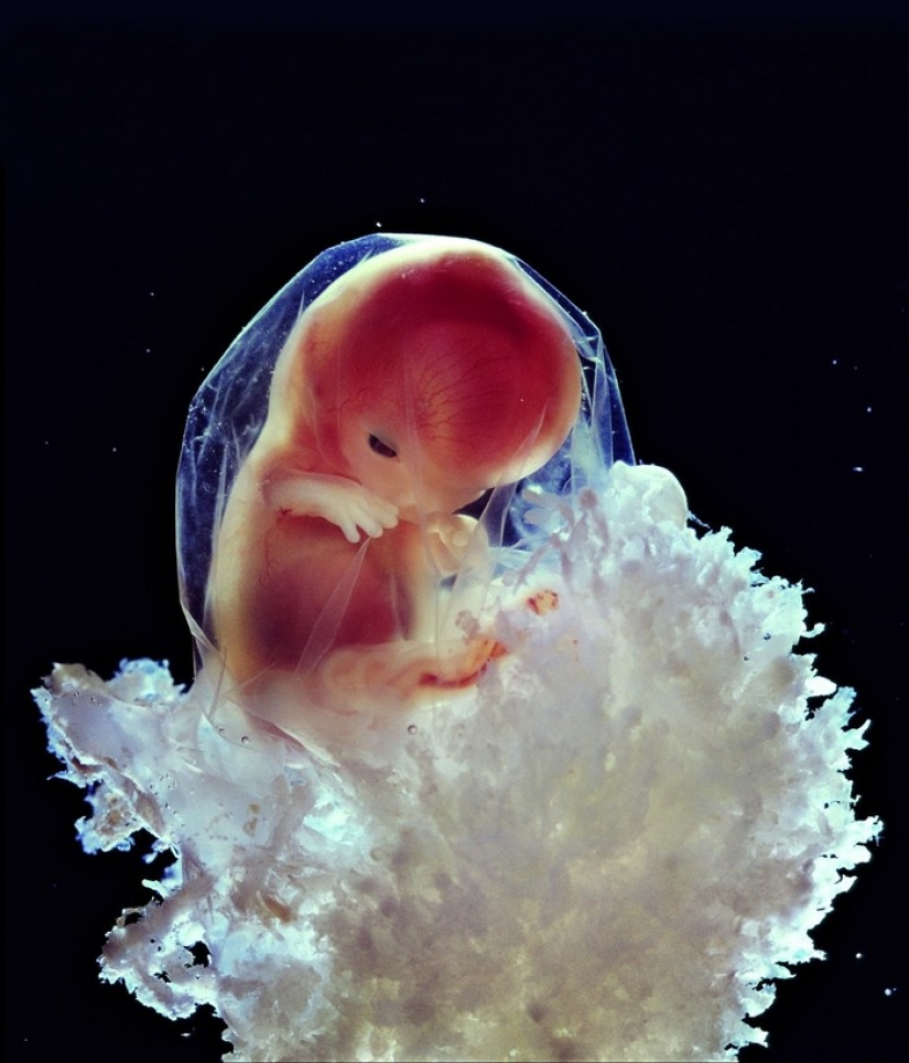 Unique footage from conception to birth