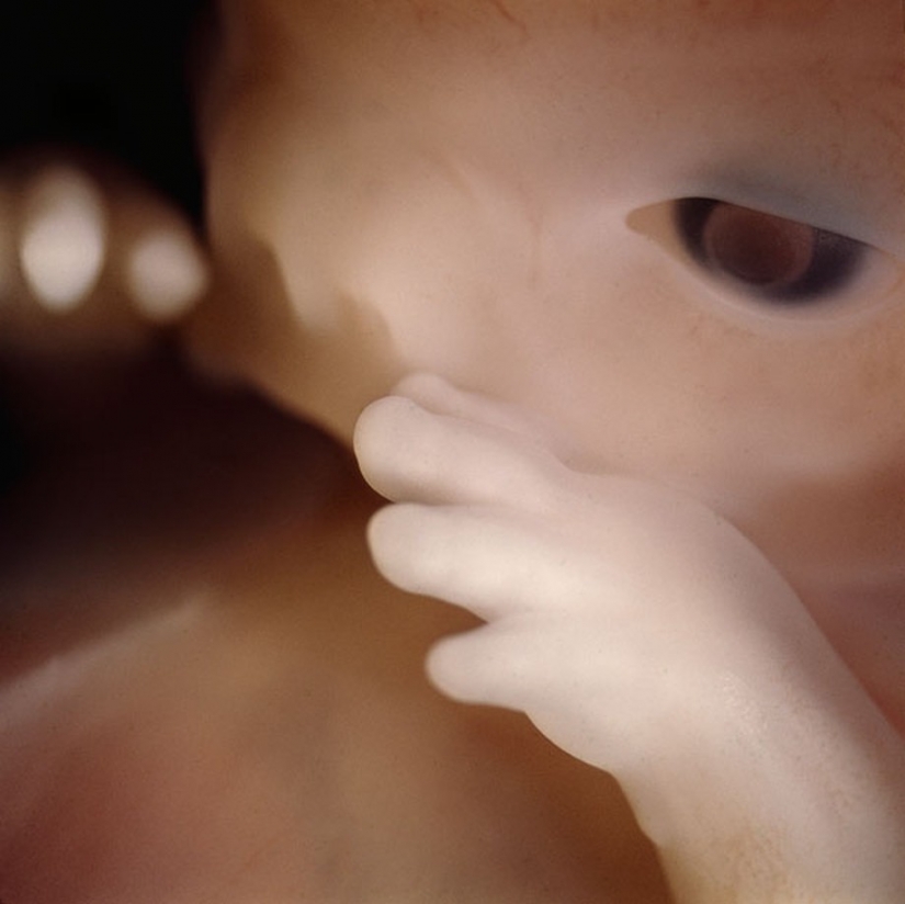 Unique footage from conception to birth