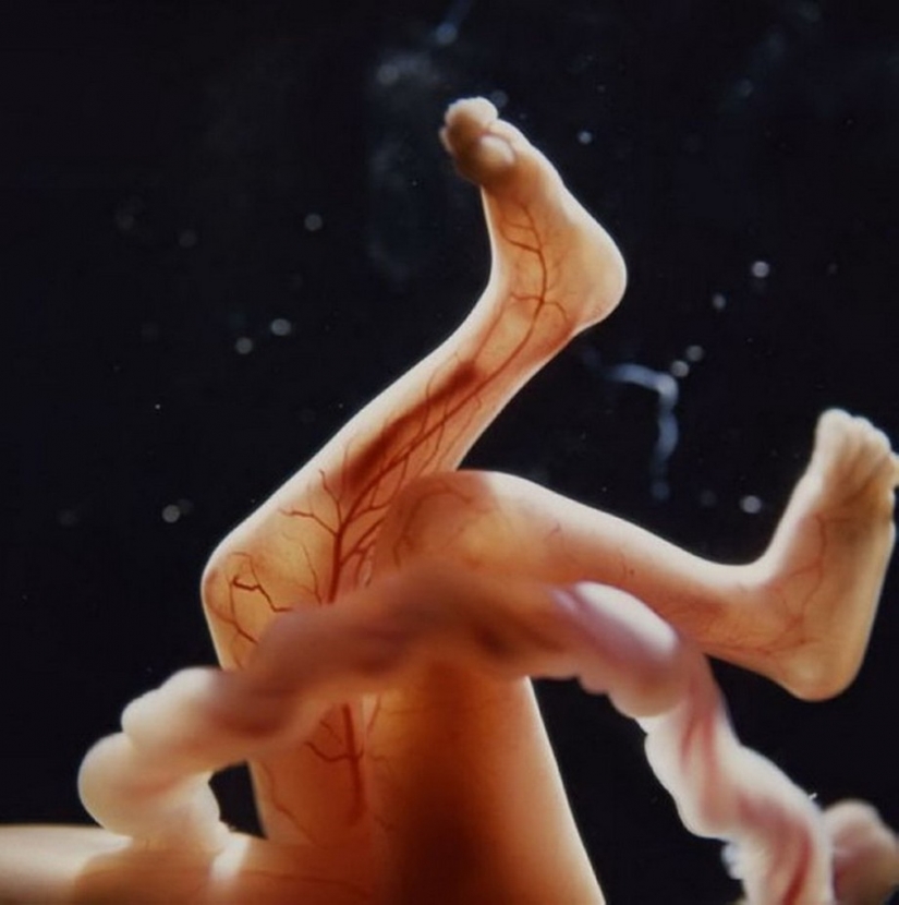 Unique footage from conception to birth