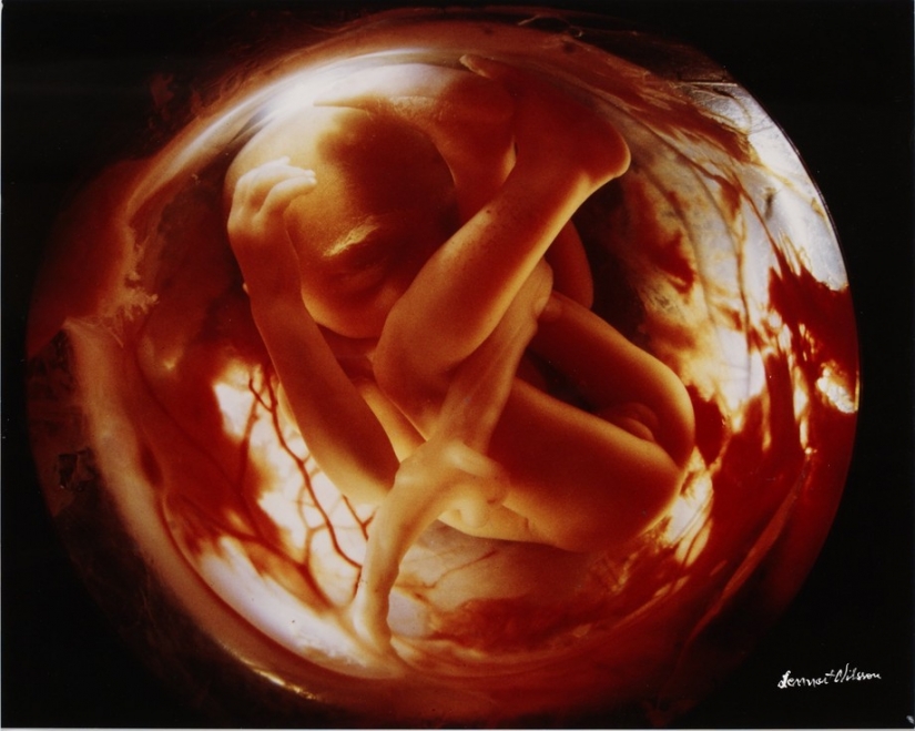 Unique footage from conception to birth