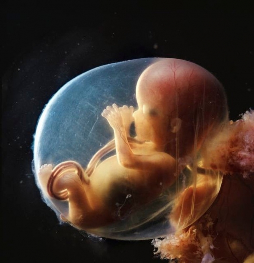 Unique footage from conception to birth