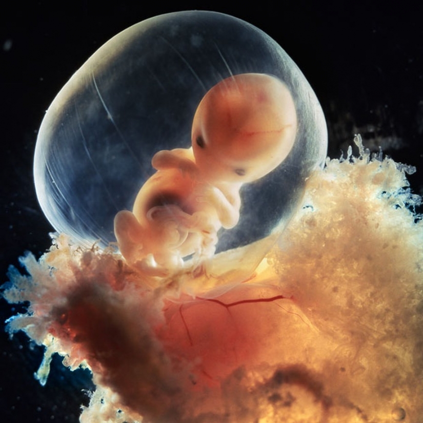 Unique footage from conception to birth