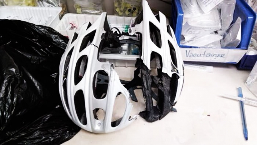 Watch your head: victims in accidents shared the photos of helmets that saved their lives