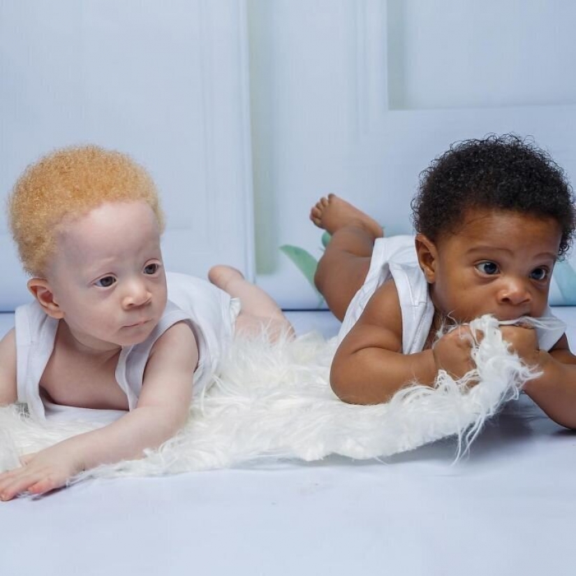 What is the secret of twins with different skin colors from Nigeria