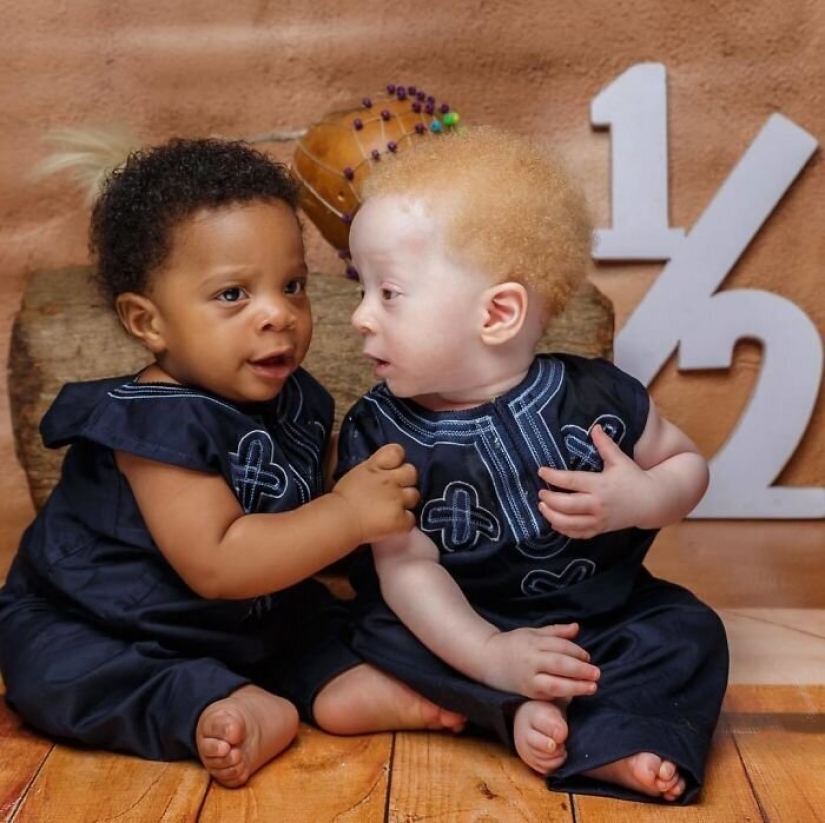 What is the secret of twins with different skin colors from Nigeria