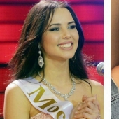 10 bellezas rusas antes y después de la cirugía plástica