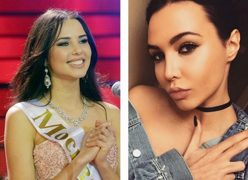 10 bellezas rusas antes y después de la cirugía plástica