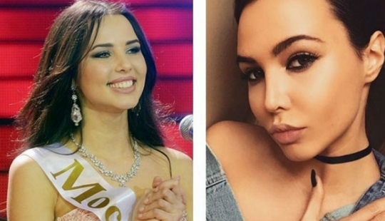 10 bellezas rusas antes y después de la cirugía plástica