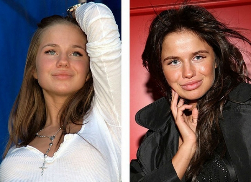 10 bellezas rusas antes y después de la cirugía plástica